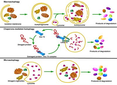 Macrophage autophagy in macrophage polarization, chronic inflammation and organ fibrosis